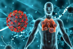 How to Boost Your Immune System Naturally